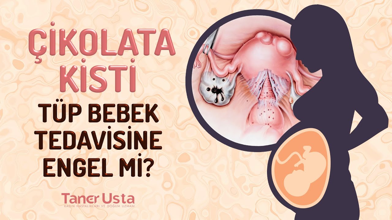 Prof. Dr. Taner Usta - Kadın Hastalıkları ve Doğum Uzmanı